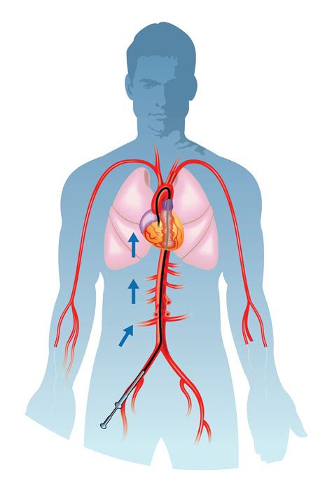 Coronary Angiography – Batra Heart & Multispecialty Hospital