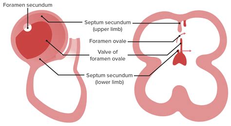 Development of the Heart | Concise Medical Knowledge