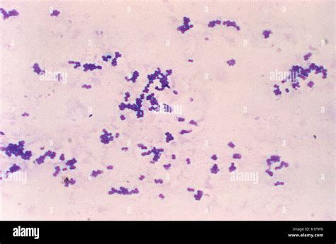 Enterococcus Faecalis Gram Stain Morphology