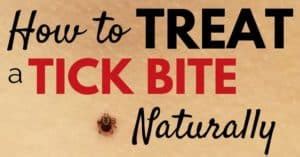 How to Treat a Tick Bite Naturally - What to Do After Removing a Tick