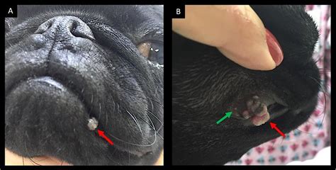 A) Lesion in the lower lip, medial portion, cauliflower -like growth,... | Download Scientific ...