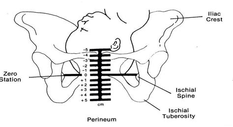 Pin on Pregnancy & Childbirth