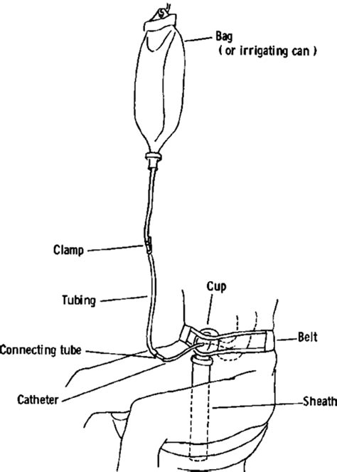 Equipment For Colostomy Irrigation