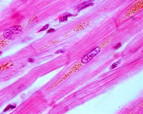 Heart muscle cells, light micrograph - Stock Image - C036/1292 - Science Photo Library