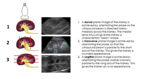 Kidney Ultrasound Images Abnormal