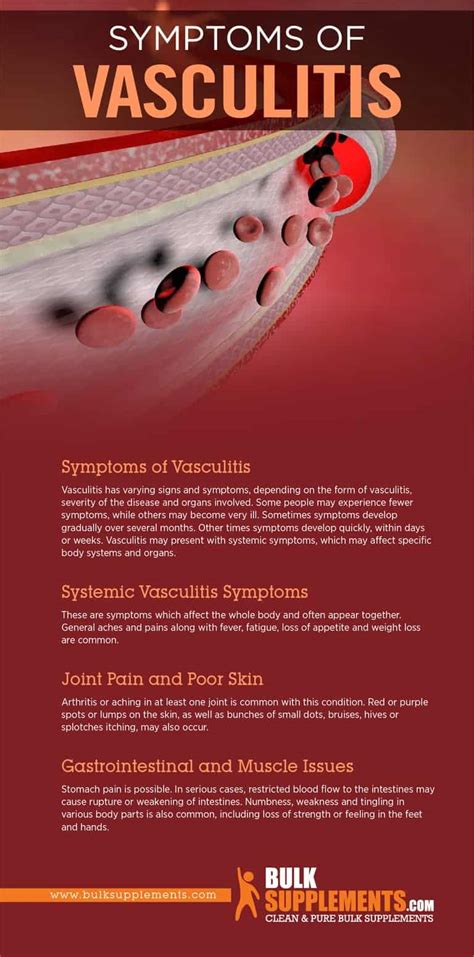 Vasculitis: Symptoms, Causes & Treatment