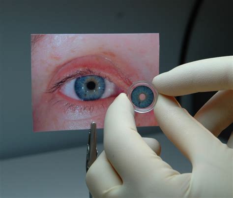 FDA Approves First Artificial Iris - Legacy MEDSearch