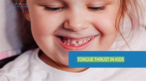 Tongue Thrust in Kids: Causes, Diagnosis, and Treatment