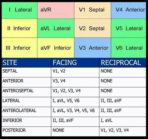 12 lead | Cardiac nursing, Ekg interpretation, Icu nursing