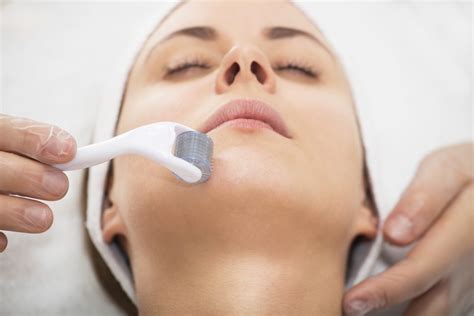 Microneedling: Important Facts