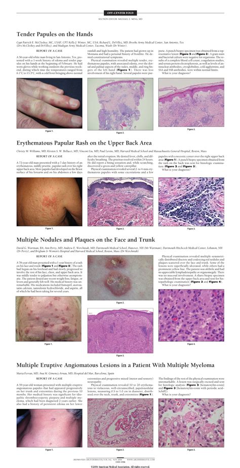 Multiple Eruptive Angiomatous Lesions in a Patient With Multiple ...