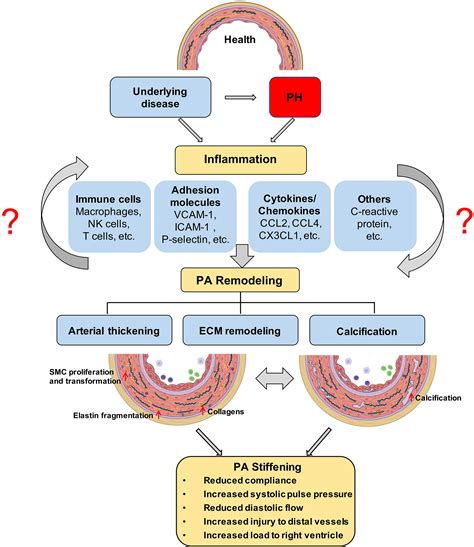 Frontiers | Pulmonary hypertension: Linking inflammation and pulmonary arterial stiffening