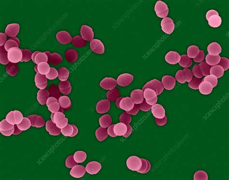 Enterococcus faecium, SEM - Stock Image - C032/2605 - Science Photo Library