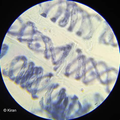 Spirogyra Under Compound Microscope