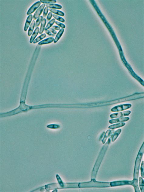 Fusarium Spores