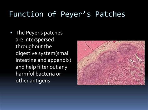 PPT - Immune System PowerPoint Presentation - ID:2140110