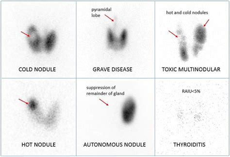 Pin on Nuclear Medicine and Radiology (NUCRADSHARE.COM)