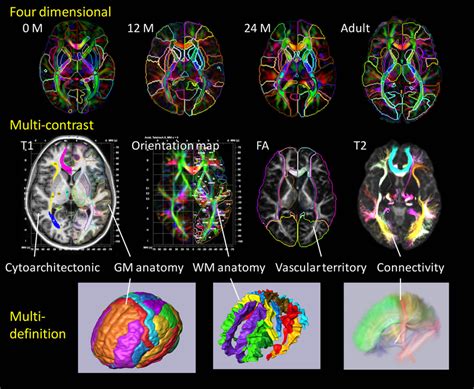 Panels show a current brain atlas, including 3D anatomical information... | Download Scientific ...