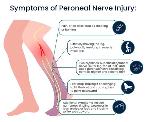 Peroneal Nerve Treatment in NYC | Pain Management NYC