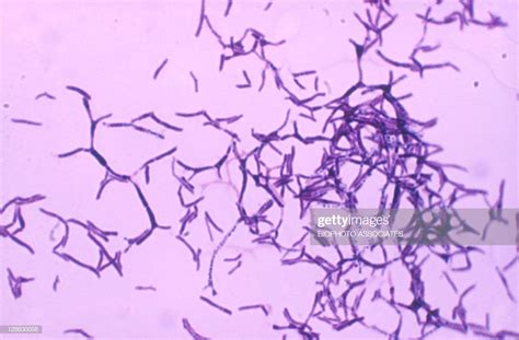 Actinomyces Colony Gram Stain Showing Branching Forms Magnification ...