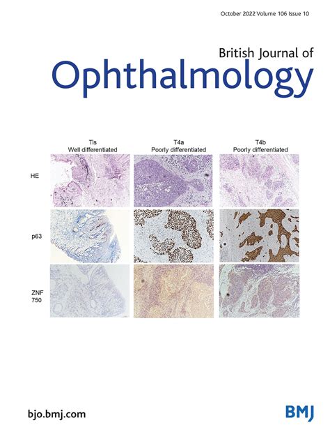 Topical carbonic anhydrase inhibitors and glaucoma in 2021: where do we stand? | British Journal ...