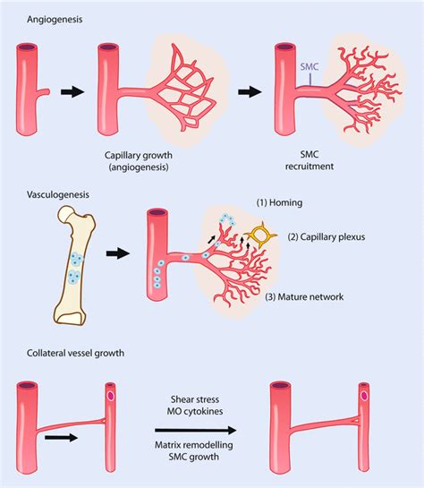 Collateral Circulation | SpringerLink