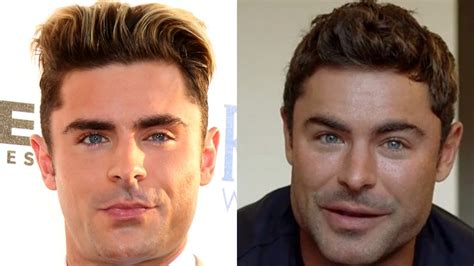 Zac Efron reveals what led to plastic surgery rumors after viral photos - TAnvir Ahmed Anontow