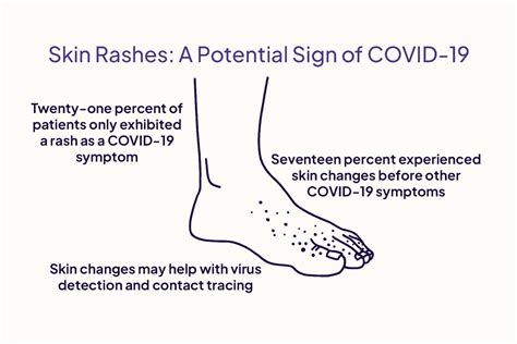 Covid Symptoms Rash 2024 - Bianca Zahara