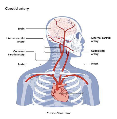 Carotid artery neck pain: Symptoms, causes, and more