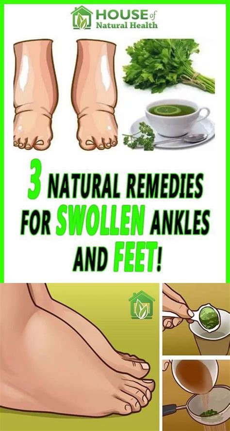 Pin by Tamelia Mendez on Reduce Weight | Foot remedies, Swollen feet remedy, Migraines remedies