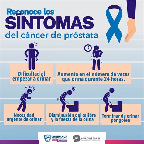 Emite recomendaciones para conocer síntomas del cáncer de próstata ...