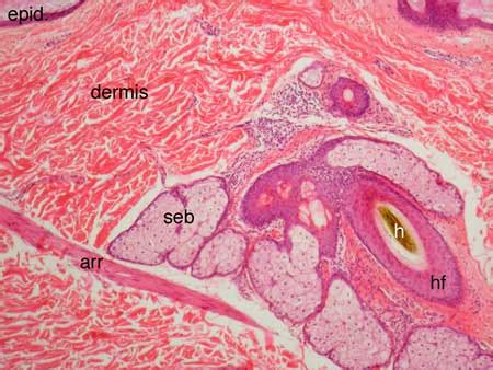 Sebaceous Glands Histology