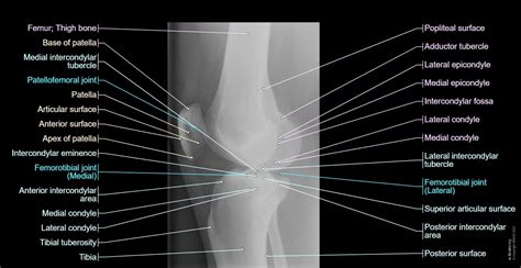 Anatomy of the knee (CT arthrography) | e-Anatomy