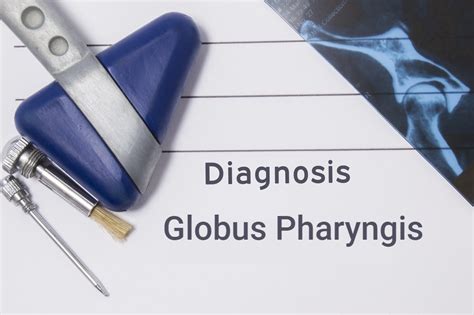 Is Globus Pharyngis (A Lump in the Throat) Serious? - Facty Health