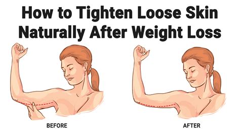 How to Tighten Loose Skin Naturally After Weight Loss