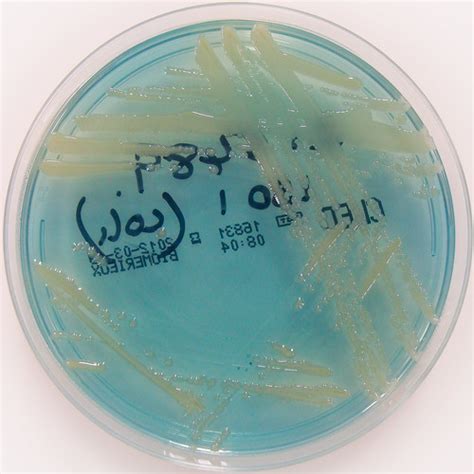 Enterobacter aerogenes on C.L.E.D. agar | Nathan Reading | Flickr