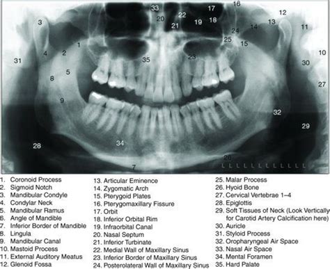 Dentaltown - Anatomical landmarks on a Panoramic radiograph | Dental emergency, Dental, Dental ...