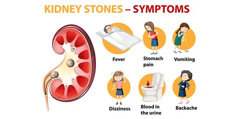 What Are Early Signs of Kidney Stones?
