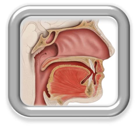 Assessment and Treatment of Velopharyngeal Insufficiency - Bilinguistics