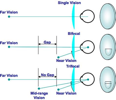 سبکهای عدسیها Lens Styles