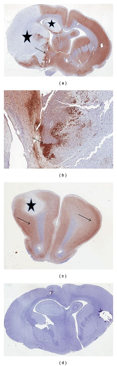 Pimonidazole stain identifies penumbra. (a) Intense staining is present ...