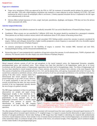 Issues in brainmapping...Temporal lobe epilepsy | PDF