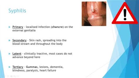 Spirochetes Symptoms