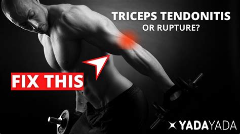 Triceps Tendonitis or Rupture? Signs, symptoms, and treatment options ...