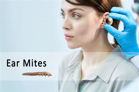 Ear Mites in Humans, Symptoms, and Treatment | Ungex