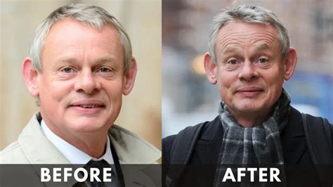 Martin Clunes Weight Loss [2024]: Before and After