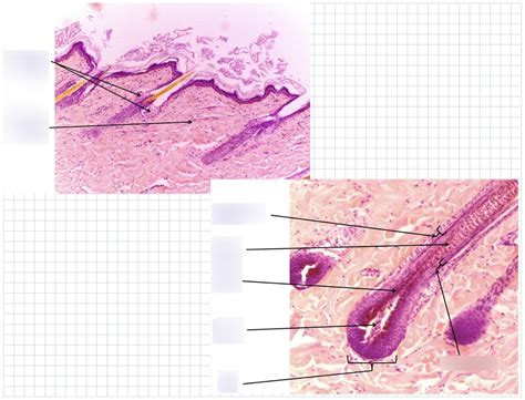 Lab D - Hair + Sebaceous gland + piloerector muscle Diagram | Quizlet