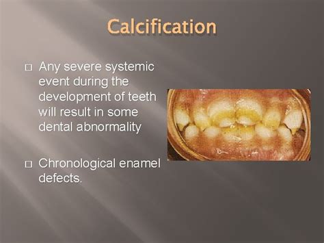 CHRONOLOGY AND MORPHOLOGY OF PRIMARY AND PERMANENT TEETH