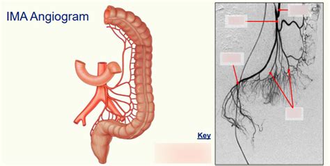 Diagram of Inferior mesenteric artery angiogram. | Quizlet