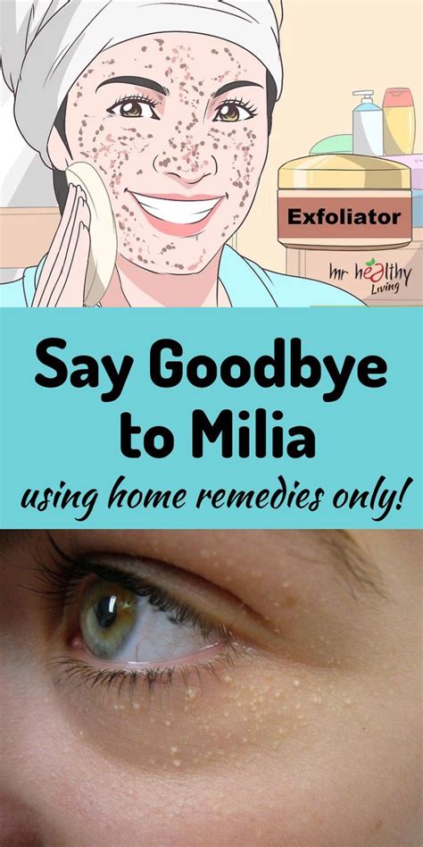 Milia #+ #Milia #removal #+ #Milia #removal #diy #+ #Milia #removal # ...